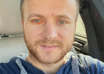 Constatare amară: Dacă pentru un senator PSD-ist deranjat la stomac s-a găsit un elicopter SMURD, activistul de mediu Daniel Bodnar nu a avut parte de același tratament, deși se zbate între viață și moarte. Rușine să ne fie
