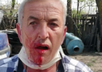 Un voluntar care acționa în scopuri umanitare a fost BĂTUT cu bestialitate de un primar PSD! Victima a avut nevoie de intervenția unui echipaj SMURD